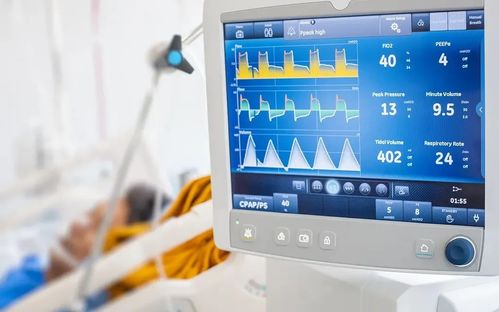 高值医械国产替代路径探析 微创模式与ST模式呼吸机的未来发展