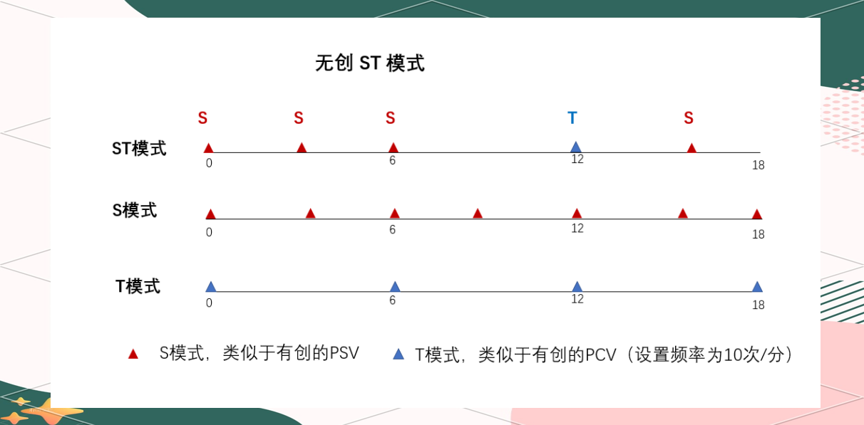 ST模式与有创呼吸机P-A/C、PSV模式的比较分析